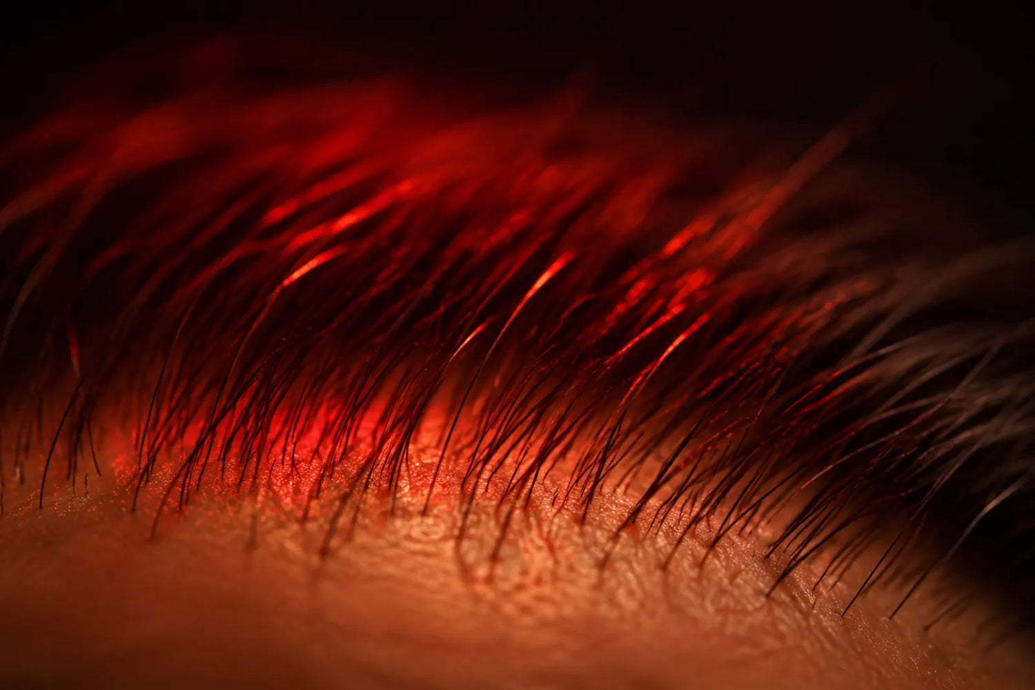 Healthy scalp and hair under red light therapy