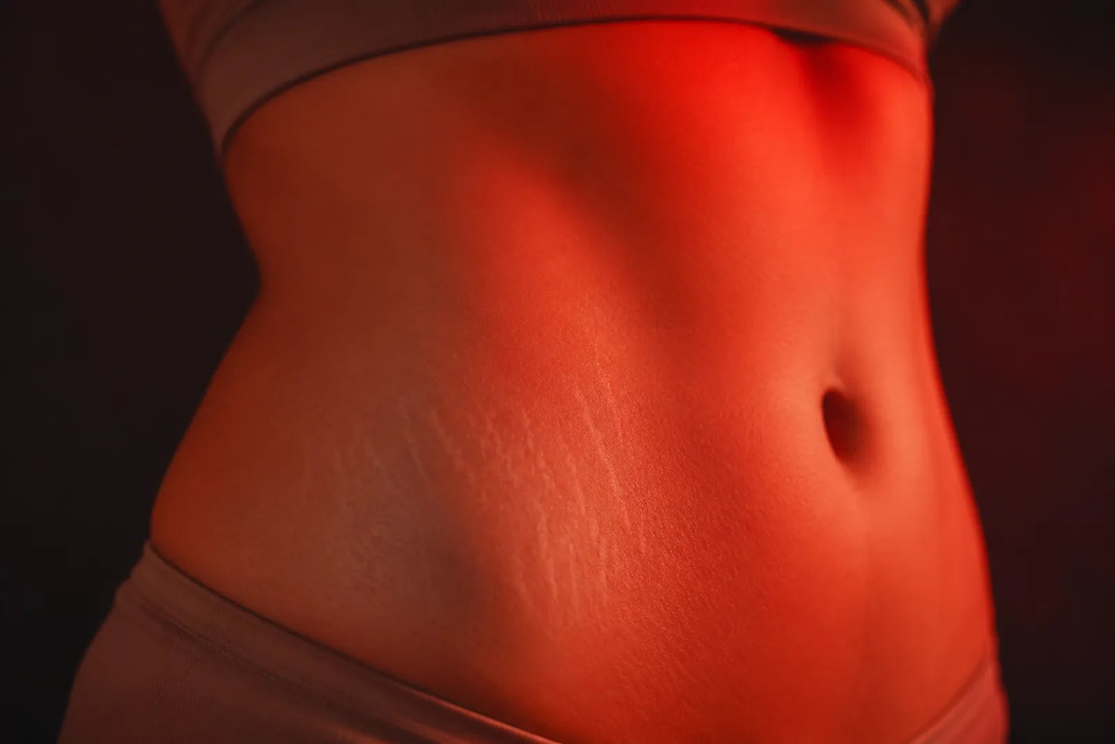 Smooth skin with stretch marks under soft red light therapy