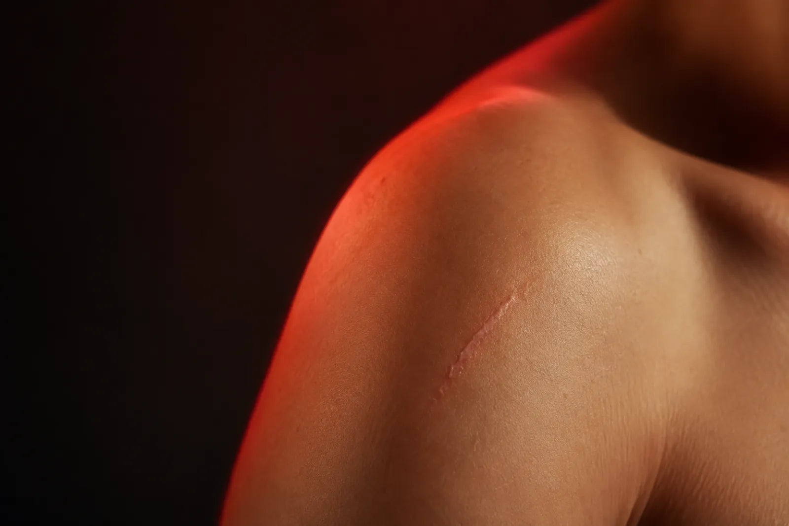 Smooth skin with a faded scar healing under red light therapy