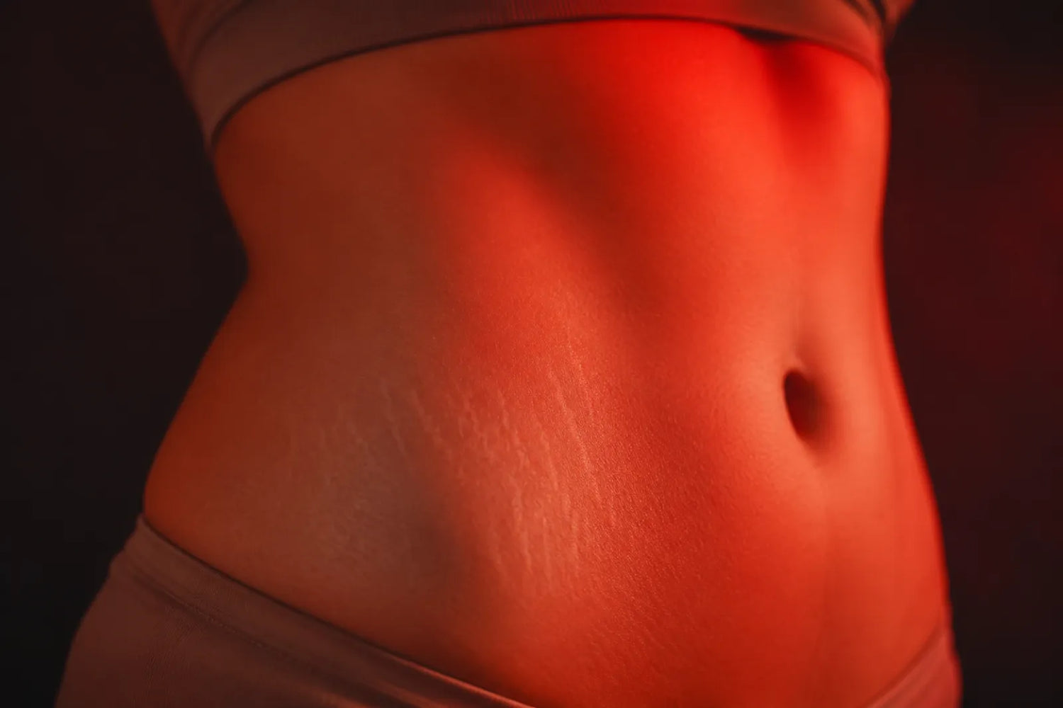 Smooth skin with stretch marks under soft red light therapy